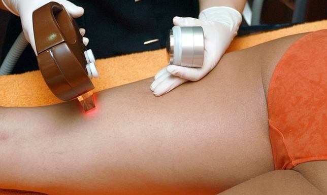 Depilacja laserowa – wszystko, co musisz o niej wiedzieć